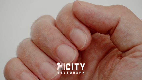 Covid, your nails can tell you if you have passed the disease